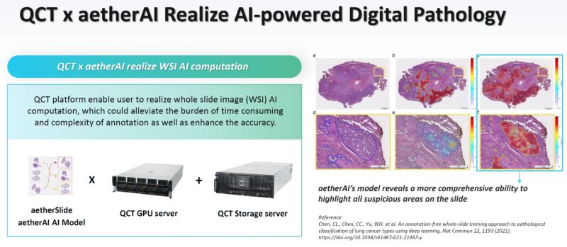 QCT X AetherAI Solution For Digital Pathology 1